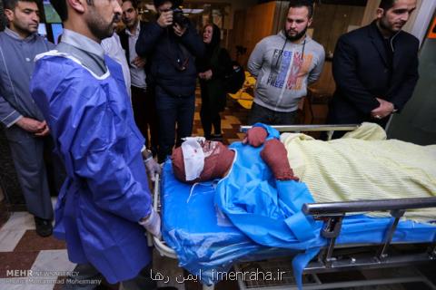بیشترین صدمه های حوادث چهارشنبه سوری، وضعیت تخت های سوختگی