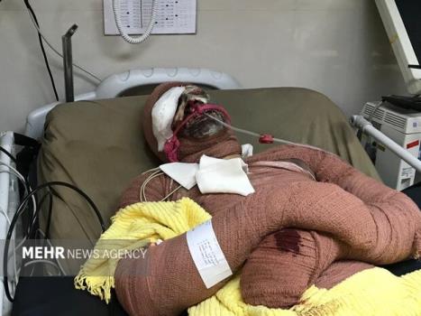 ۲۳ نفر در حوادث چهارشنبه سوری خراسان رضوی مصدوم شدند