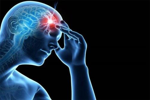 سکته های مغزی مکرر می توانند و زوال عقل عروقی
