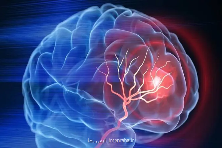 ورزش چطور از مغز در مقابل آلزایمر محافظت می کند